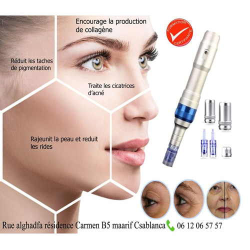 Formation microneedling